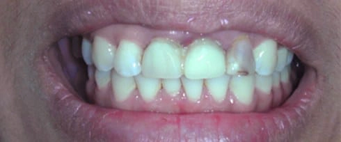 before after photo