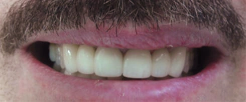 before after photo