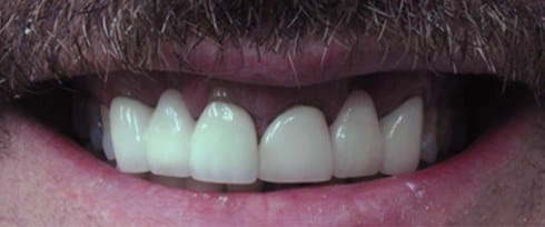 before after photo
