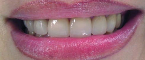 before after photo