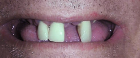before after photo
