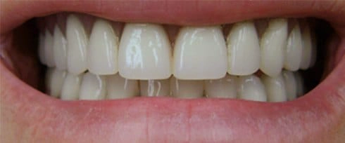 before after photo