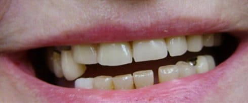 before after photo