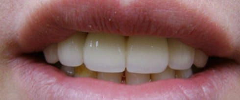 before after photo