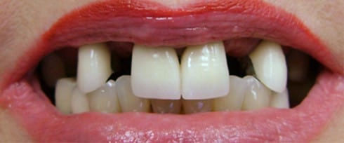 before after photo