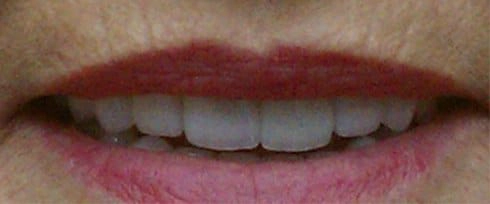before after photo