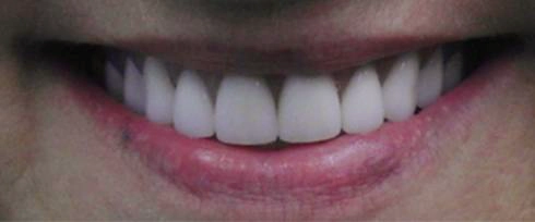 before after photo