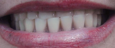 before after photo