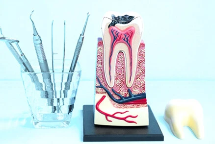 Root Canal Root Canal