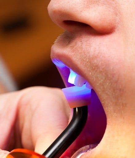 Cosmetic Dentistry Cosmetic Dentistry