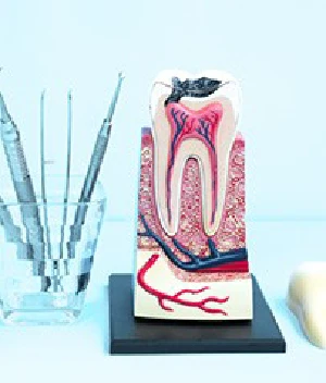 cost of root canal cost of root canal
