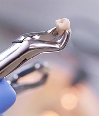 Tooth in a pair of forceps