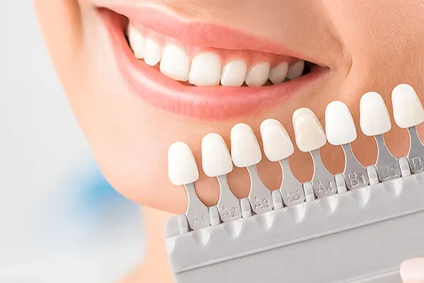 Veneers Veneers