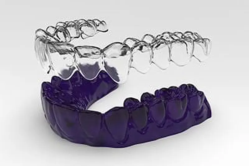 orthodontic retention orthodontic retention