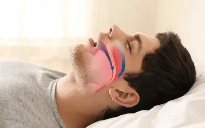 Sleep Apnea