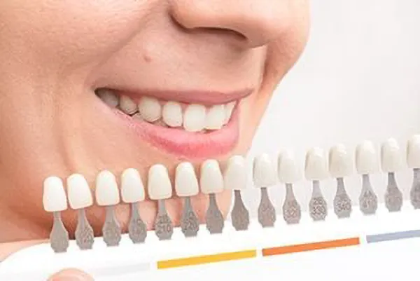 teeth whitening teeth whitening