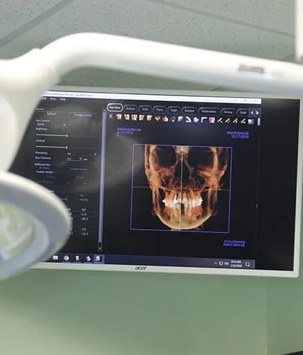 CT Scan Dental CT Scan Dental