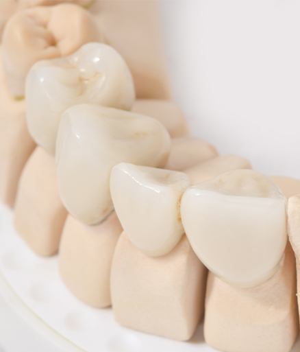 dental crowns