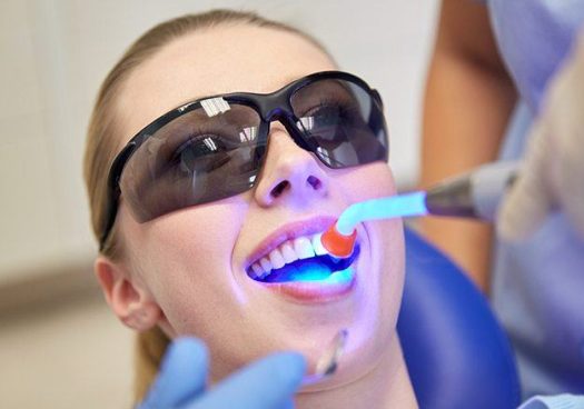 Dental Bonding
