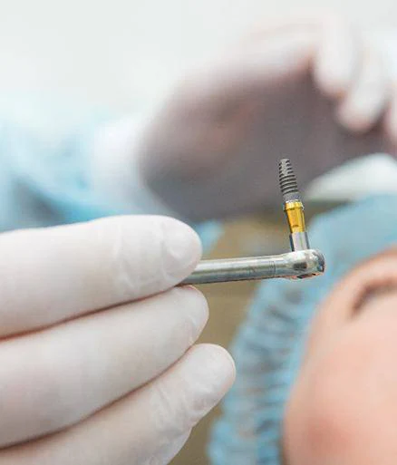 Implant Dentures