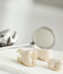 Tooth Extractions Tooth Extractions