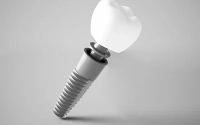 dental implant terms