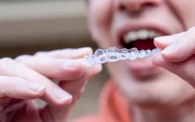 get-invisalign