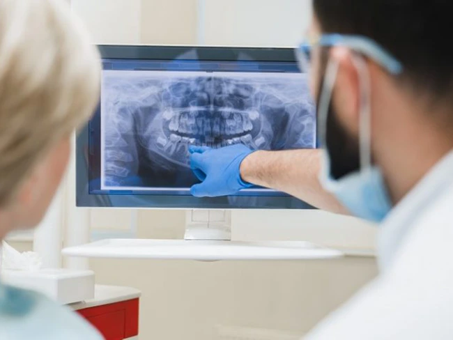 tooth enamel dentist tooth enamel dentist