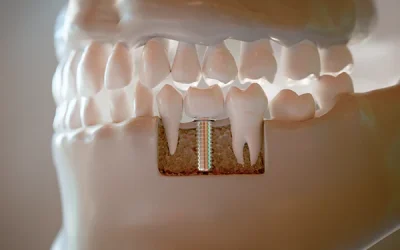 Sedation Dentist